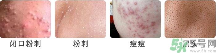 eau precieuse法国珍贵水适合人群 eau precieuse法国珍贵水适合人群