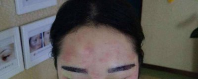 补眉毛几天掉痂快 补眉毛几天掉痂正常